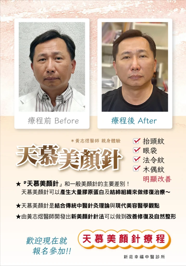 新莊中醫針灸推薦